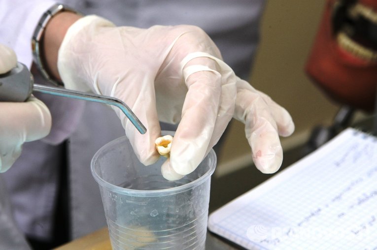 Стаматолаг ашукала пацыентку і выдаліла ёй 22 здаровыя зубы