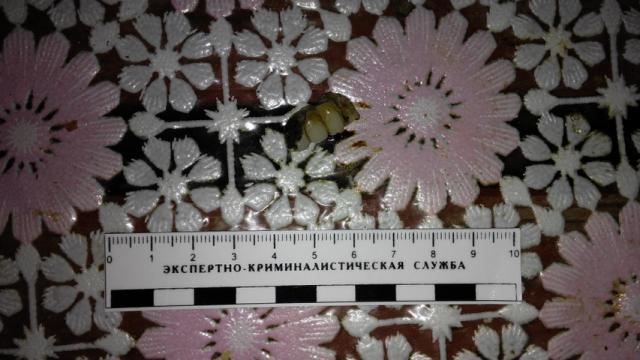 Злодзея знайшлі, дзякуючы ўстаўной сківіцы, якую ён выпадкова пакінуў (фота)