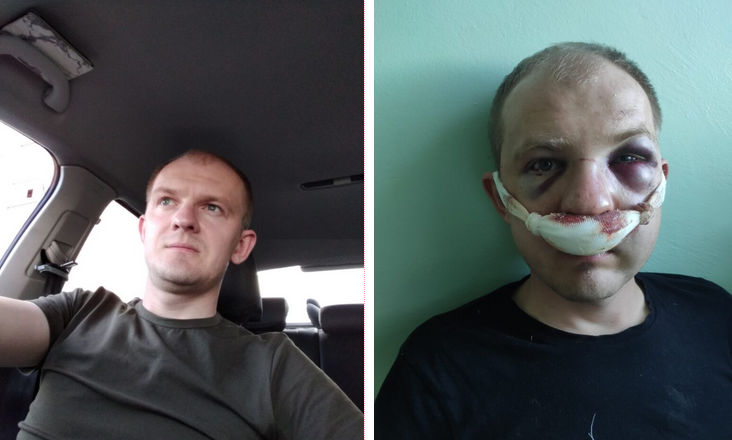 Таксіст з Гродна, збіты ў жніўні АМАПам, уцёк у Літву