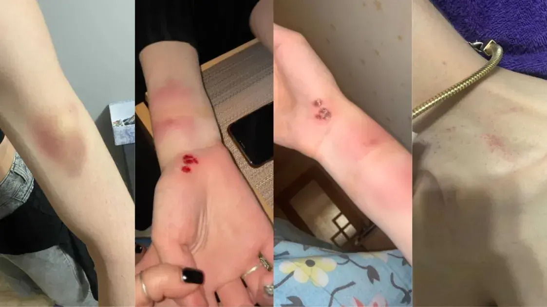 “Сейчас быть собой под запретом”. Трансдевушка — о травле в Беларуси