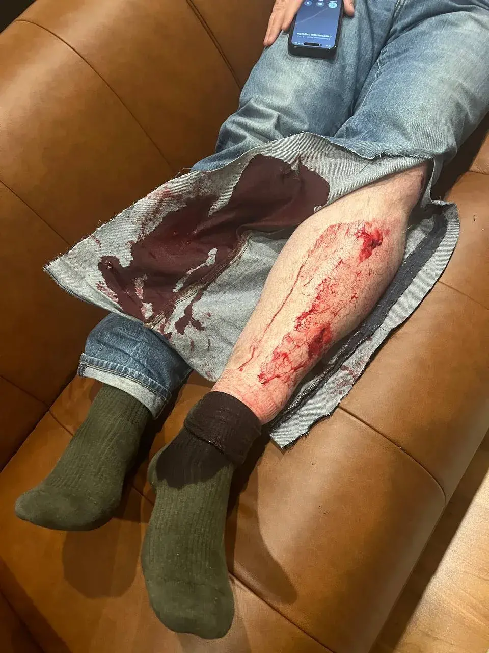 У Вільні расследуюць напад на паплечніка Навальнага