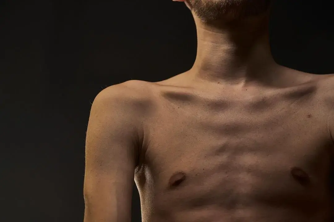 Як выглядае пасля расійскага палону "азовец" Дзмітрый Казацкі