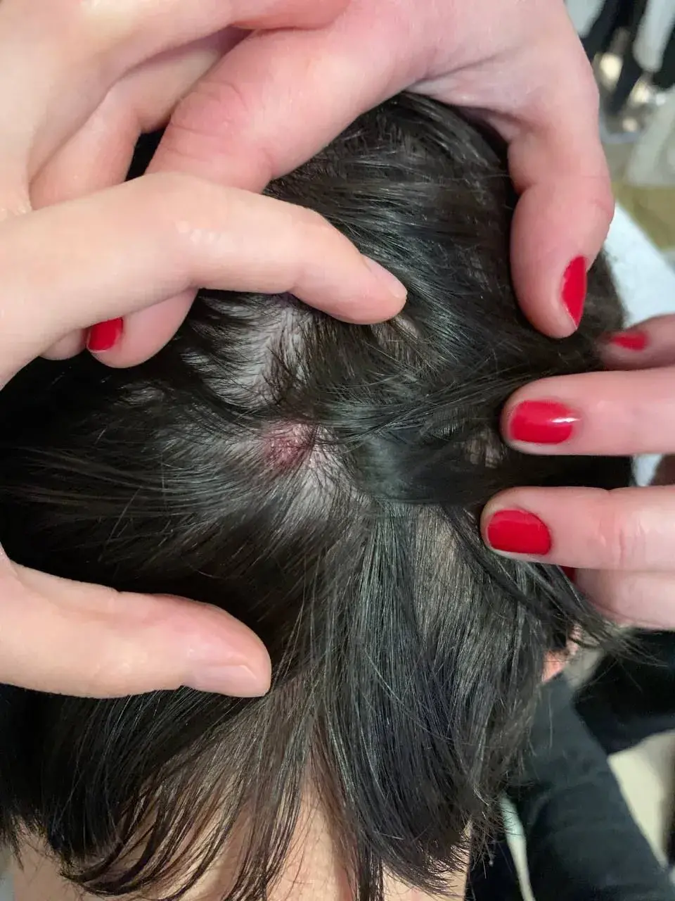 На беларуса і яго дзяўчыну напалі ў навагоднюю ноч пад Варшавай