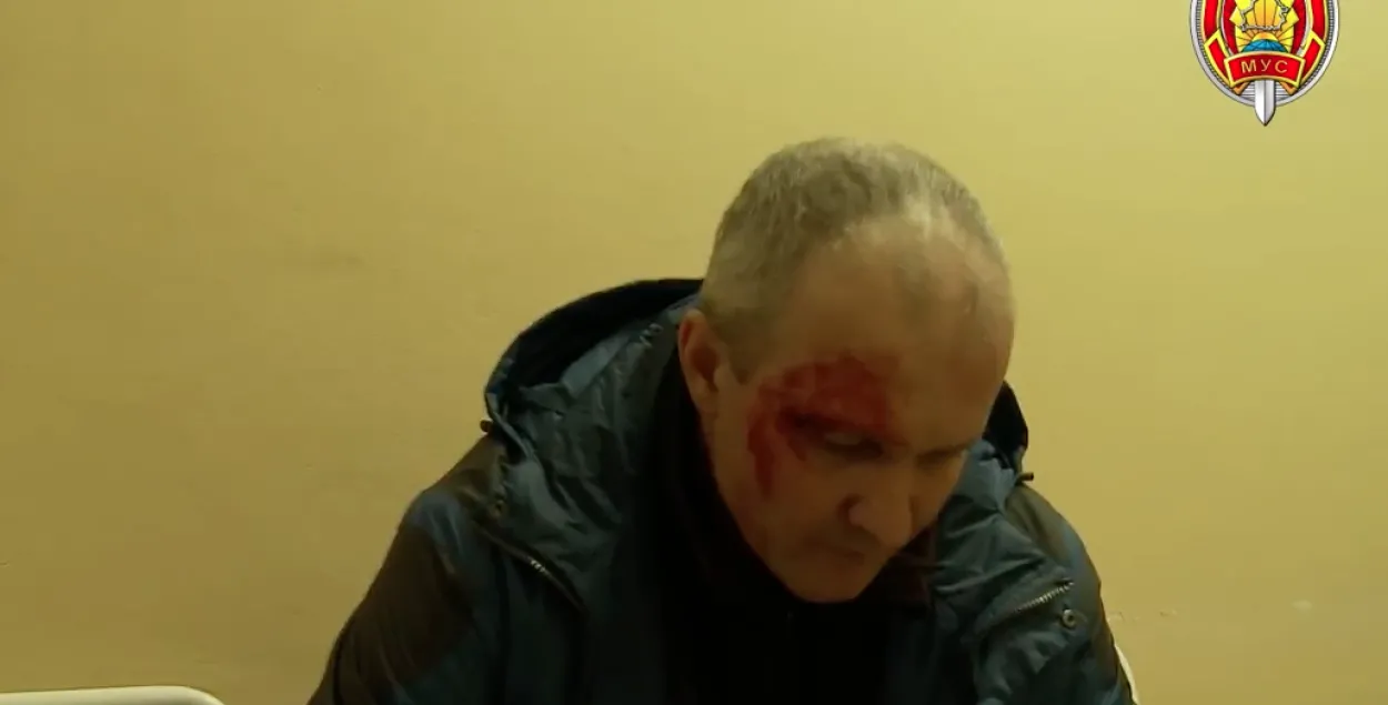 Падчас зачысткі тралейбуса міліцыянту разбілі брыво, ён шпіталізаваны