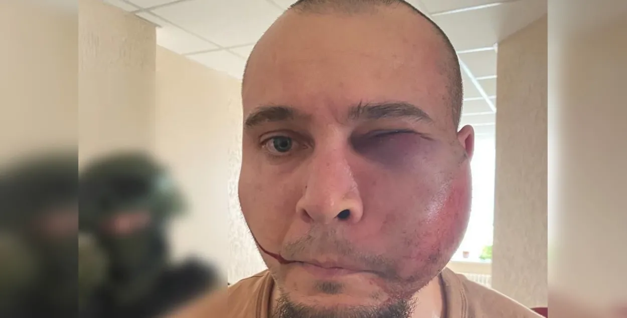 Збіты сілавікамі віцяблянін