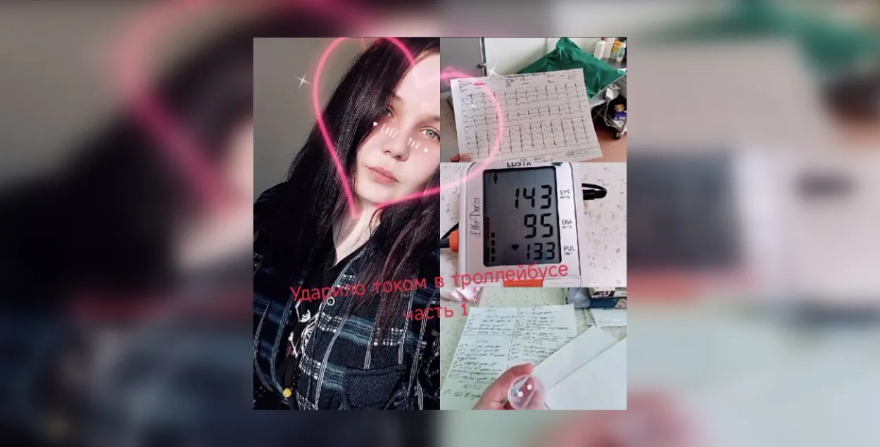 Дзіяна, якую стукнула токам у тралейбусе
