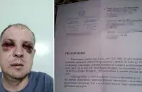 Аляксей Лапа і папера аб адмове ва ўзбуджэнні крымінальнай справы з СК​ /&nbsp;&nbsp;Блог Гродно s13