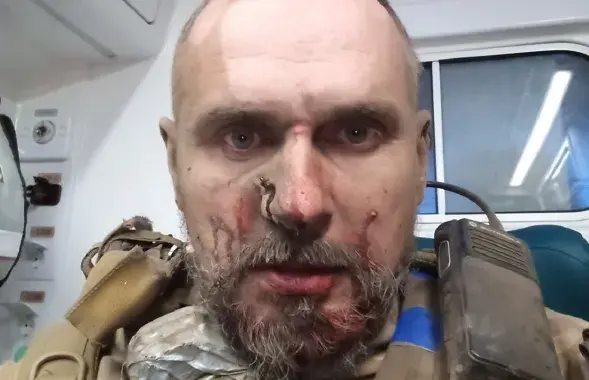 Алег Сянцоў пасля ранення / https://www.facebook.com/oleg.sentsov/
