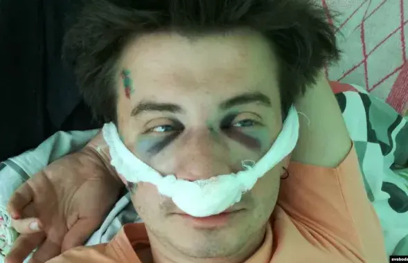 Пострадавший от нападения режиссёр Николай Куприч​ / www.svaboda.org