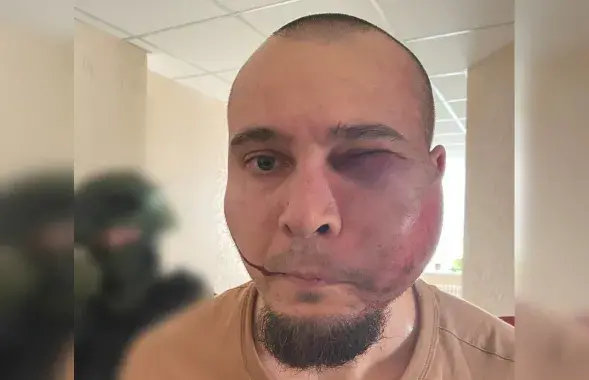 Збіты сілавікамі віцяблянін
