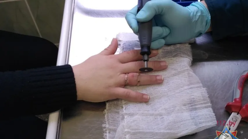 У Брэсце выклікалі МНС, каб зняць пярсцёнкі з пальца цяжарнай жанчыны