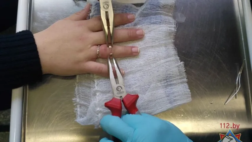 У Брэсце выклікалі МНС, каб зняць пярсцёнкі з пальца цяжарнай жанчыны